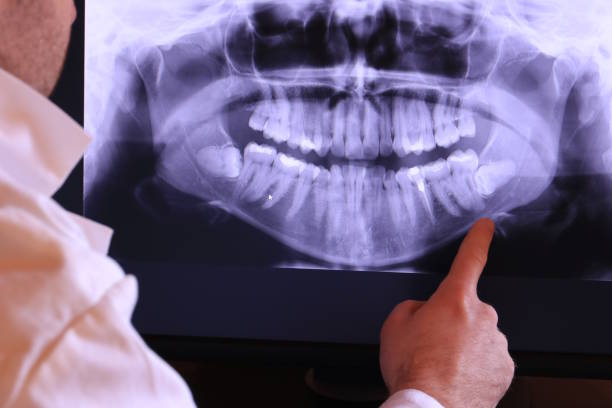 Best Pediatric Emergency Dentist in Staples, CT