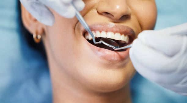 Best Emergency Wisdom Teeth Removal in Staples, CT